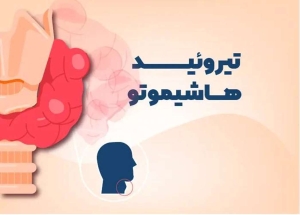 تصویر علایم یک بیماری خودایمنی شایع بر اثر اختلالات تیروئیدی را بشناسید